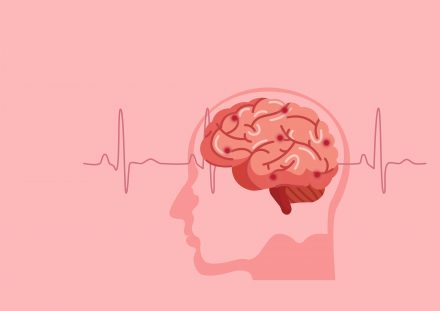 Tumores cerebrais e Radiocirurgia