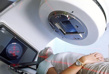 Radioterapia na batalha contra o câncer