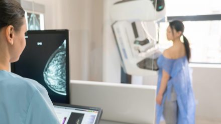 A primeira mamografia deve ser realizada aos 40, 45 ou 50 anos?