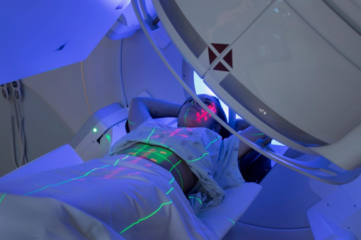 Os efeitos colateriais agudos da Radioterapia