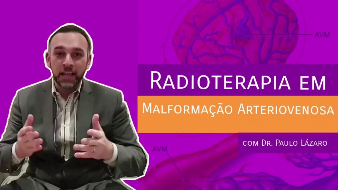 Radioterapia em Malformação Arteriovenosa