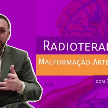 Radioterapia em Malformação Arteriovenosa