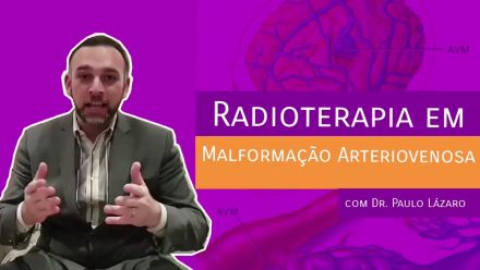 Radioterapia em Malformação Arteriovenosa