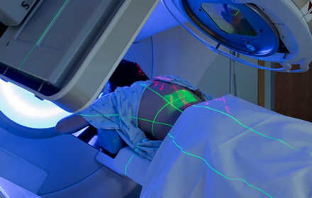 As marcas da Radioterapia