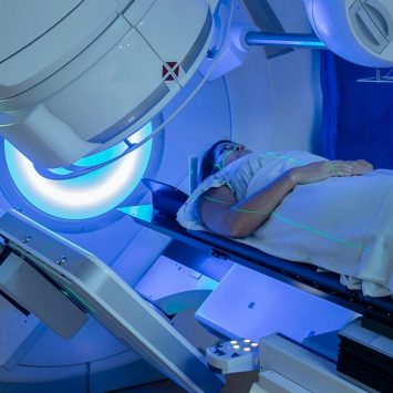 Quais os cuidados necessários para pacientes que fazem radioterapia